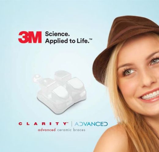 woman smiling with ceramic bracers