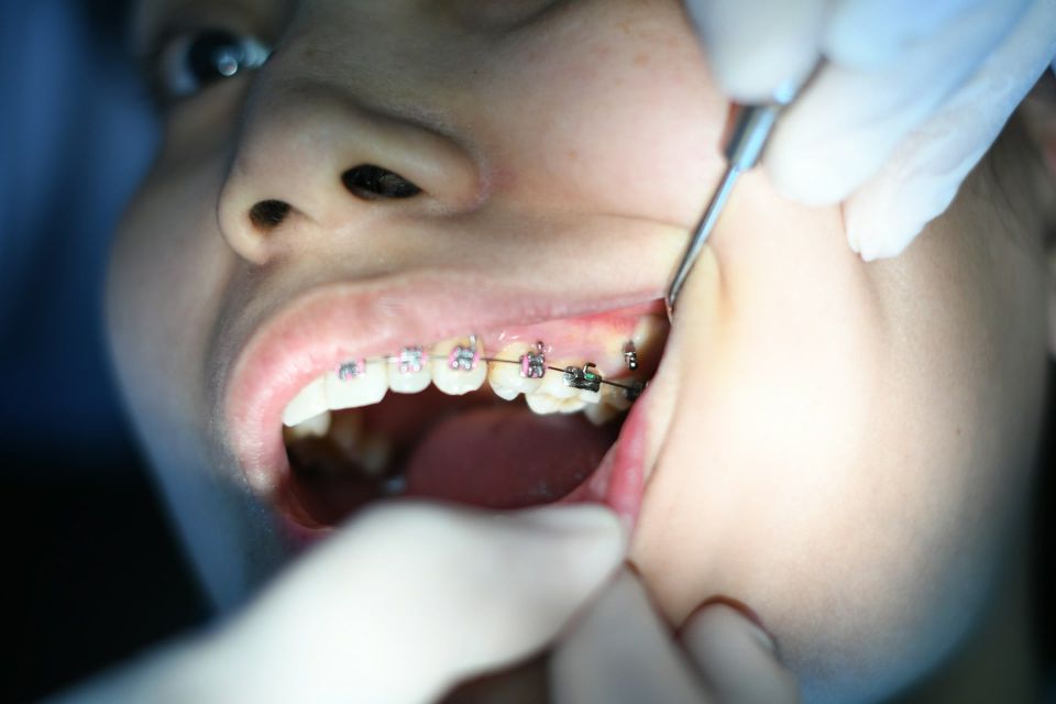 Person getting their braces adjusted