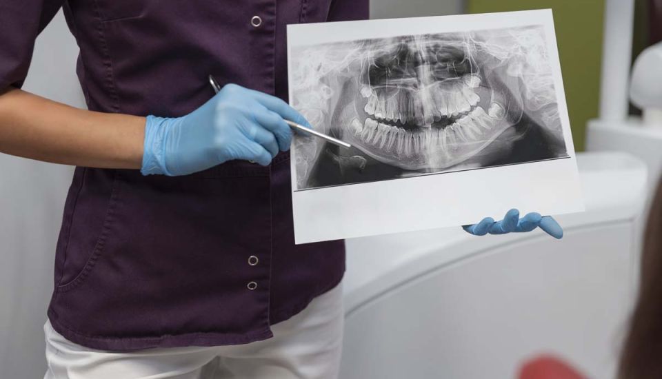 A dental professional in a maroon uniform and blue gloves holds an X-ray of teeth, pointing at it with a pen, suggesting an informative discussion.