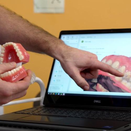 A person points to a dental diagram on a laptop screen while holding a set of dental model teeth. The setting suggests a dental education context.