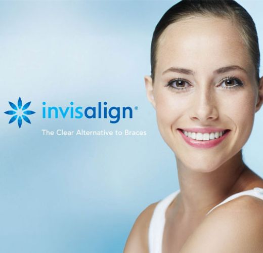 Invisalign-Aligners